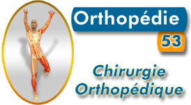 Orthopédie 53